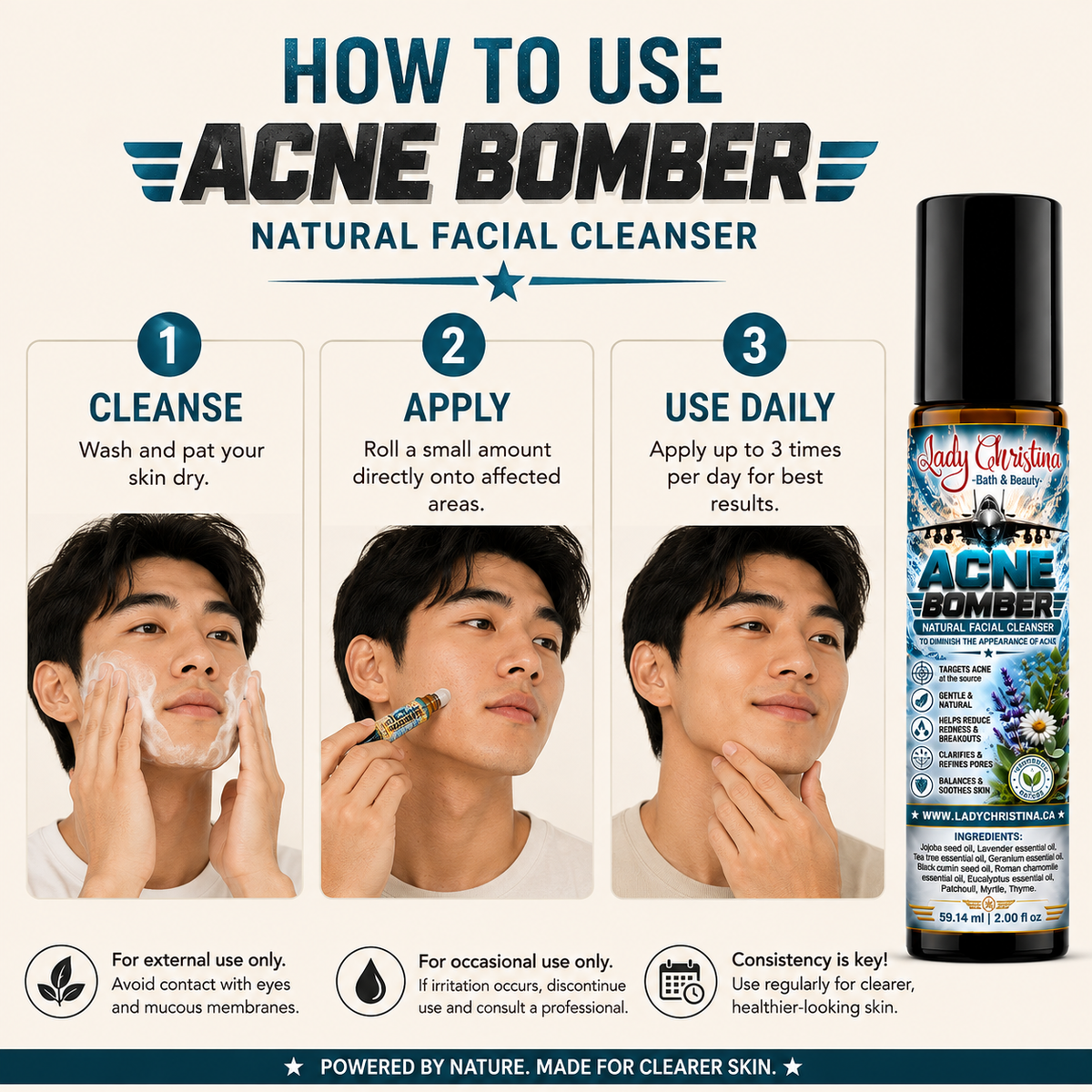Acne Bomber - photo 5