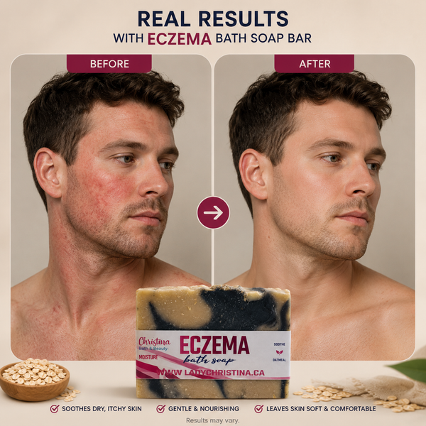 Eczema Bath Soap Bar
