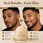 Even Skin Bundle - photo 4 4