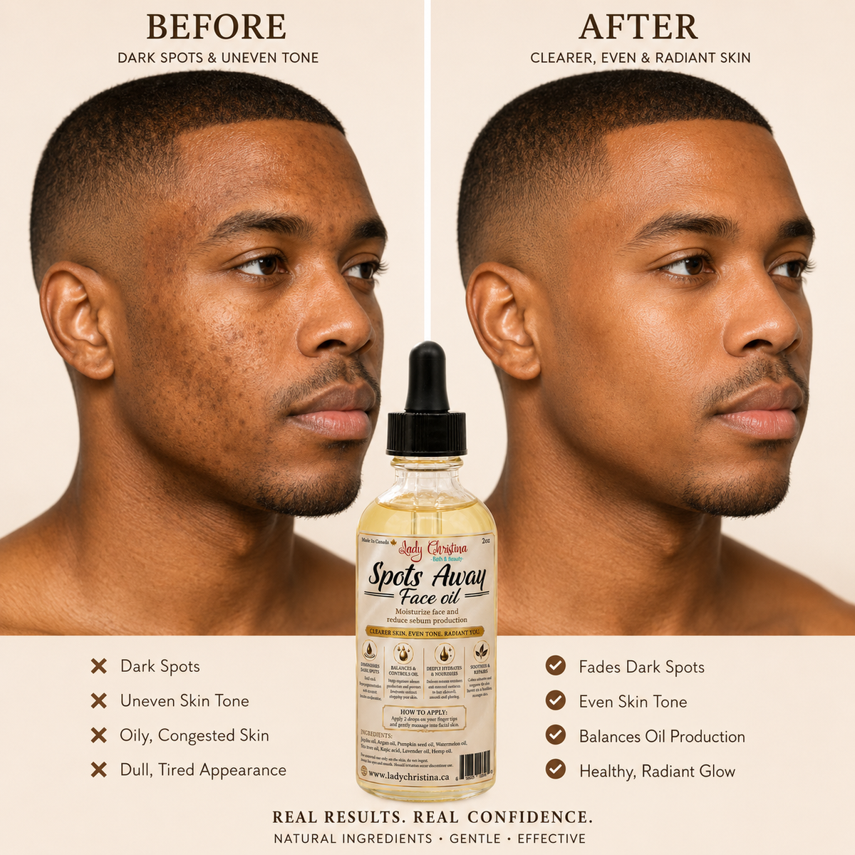 Spots Away Face oil
